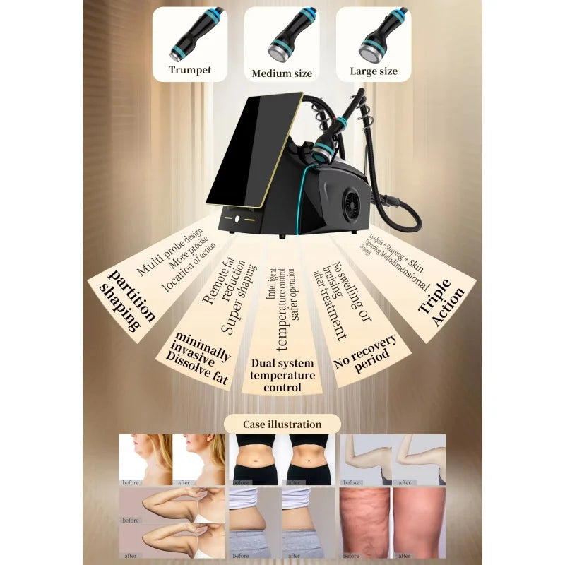 Ice Microwave 2.45GHz Skin Tightening Machine For Contouring